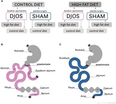 The Impact of DJOS Surgery, a High Fat Diet and a Control Diet on the Enzymes of Glucose Metabolism in the Liver and Muscles of Sprague-Dawley Rats